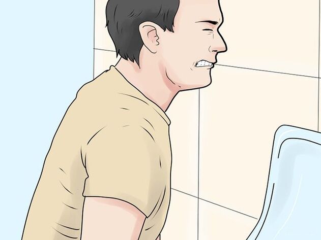 Painful urination is a sign of exacerbation of prostatitis in men